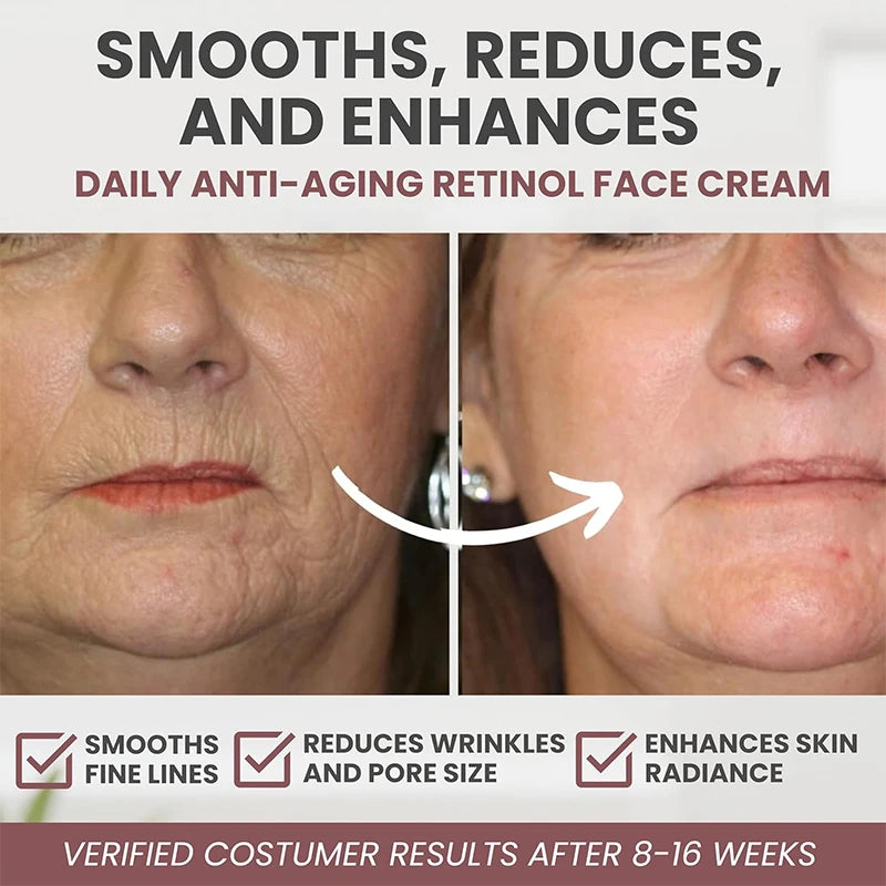 JANYIF Retinol Cream Wrinkles Anti Aging Moisturizing