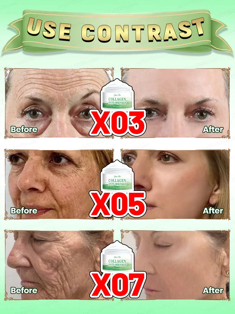 Feature Anti Aging Face Cream For Wrinkles Reduction 7 Days