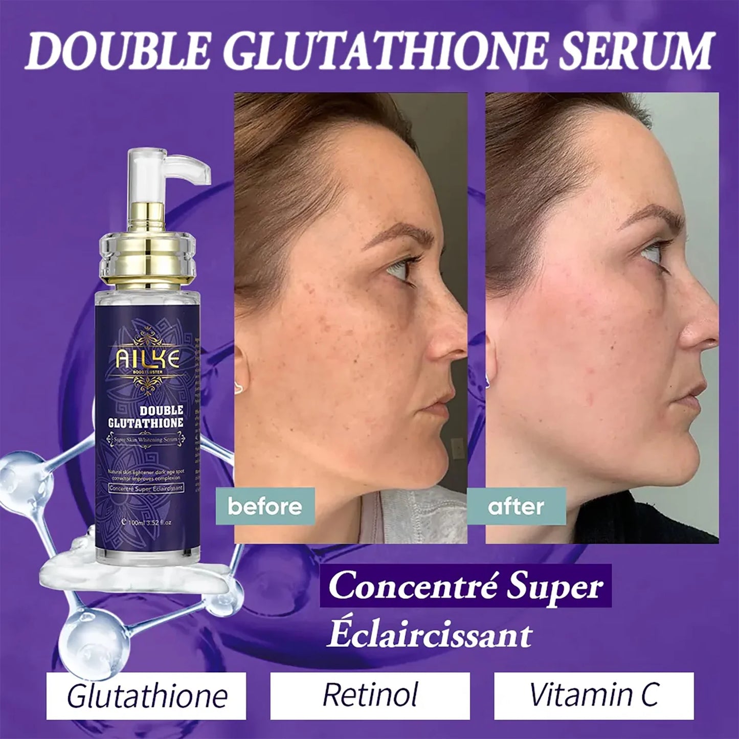 AILKE Double Glutathione Whitening Range For Radiant Skin