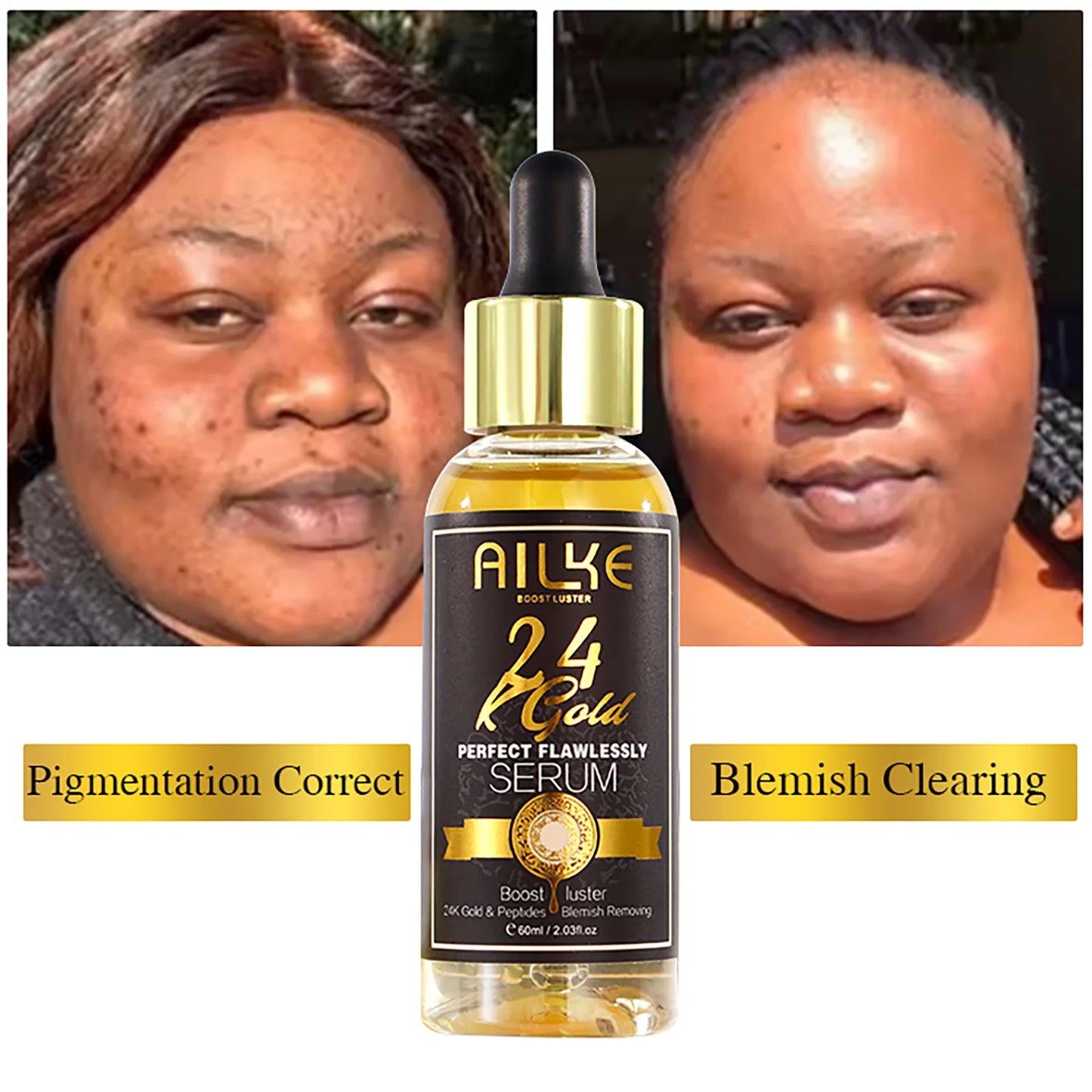 AILKE 24K Glod Flawlessly Skin Care Range, Skin Whitener, Reduce Dark Spots, Melanin, Wrinkles, Moisturize, For Women & Men